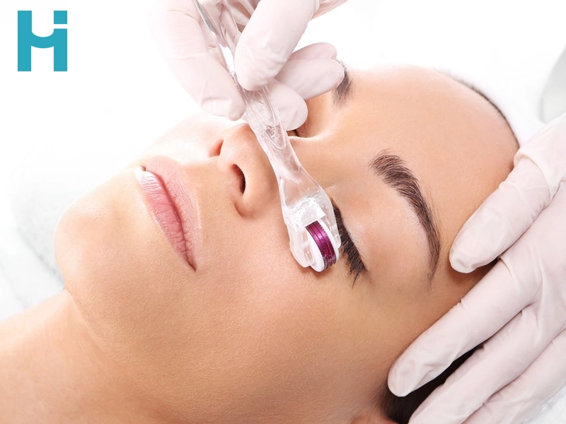 میکرونیدلینگ چیست؟ + مزایا و معایب آن