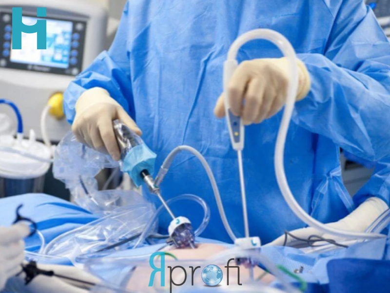 همه چیز درباره عمل لاپاراسکوپی